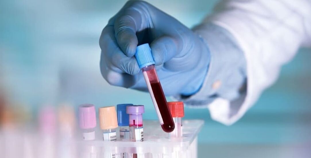 How alcohol affects blood tests