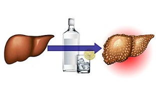 effects of alcohol on the liver